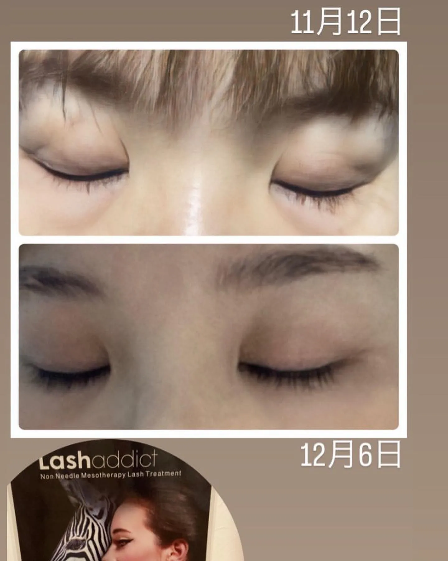 まつ毛の美しさを維持するためには、適切なアフターケアが欠かせ...