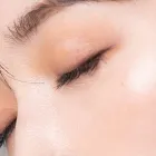 ハリウッドブロウリフト